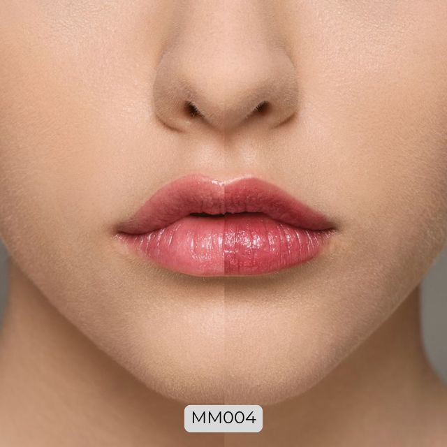 Supreme Lip Treatment